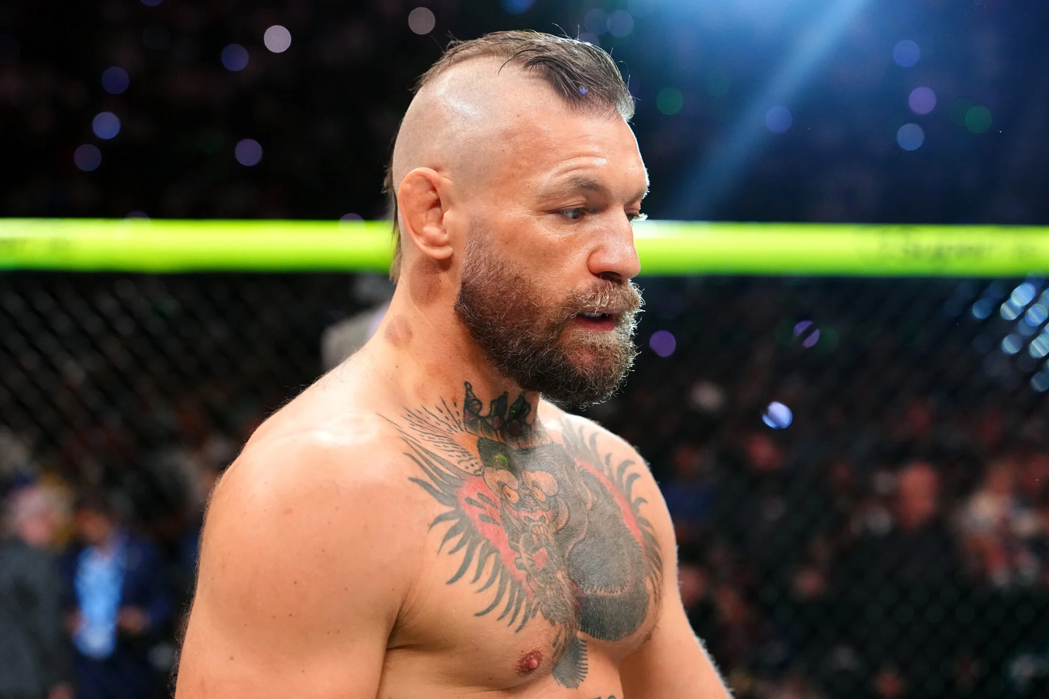 Mistério Resolvido: Conor McGregor Finalmente Passa por Cirurgia Após Médicos Estranharem Sua Recuperação Veloz