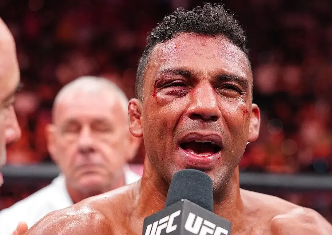 IMAGEM FORTE: Edson Barboza Abre Corte Profundo na Canela em Despedida Emocionante do UFC 330