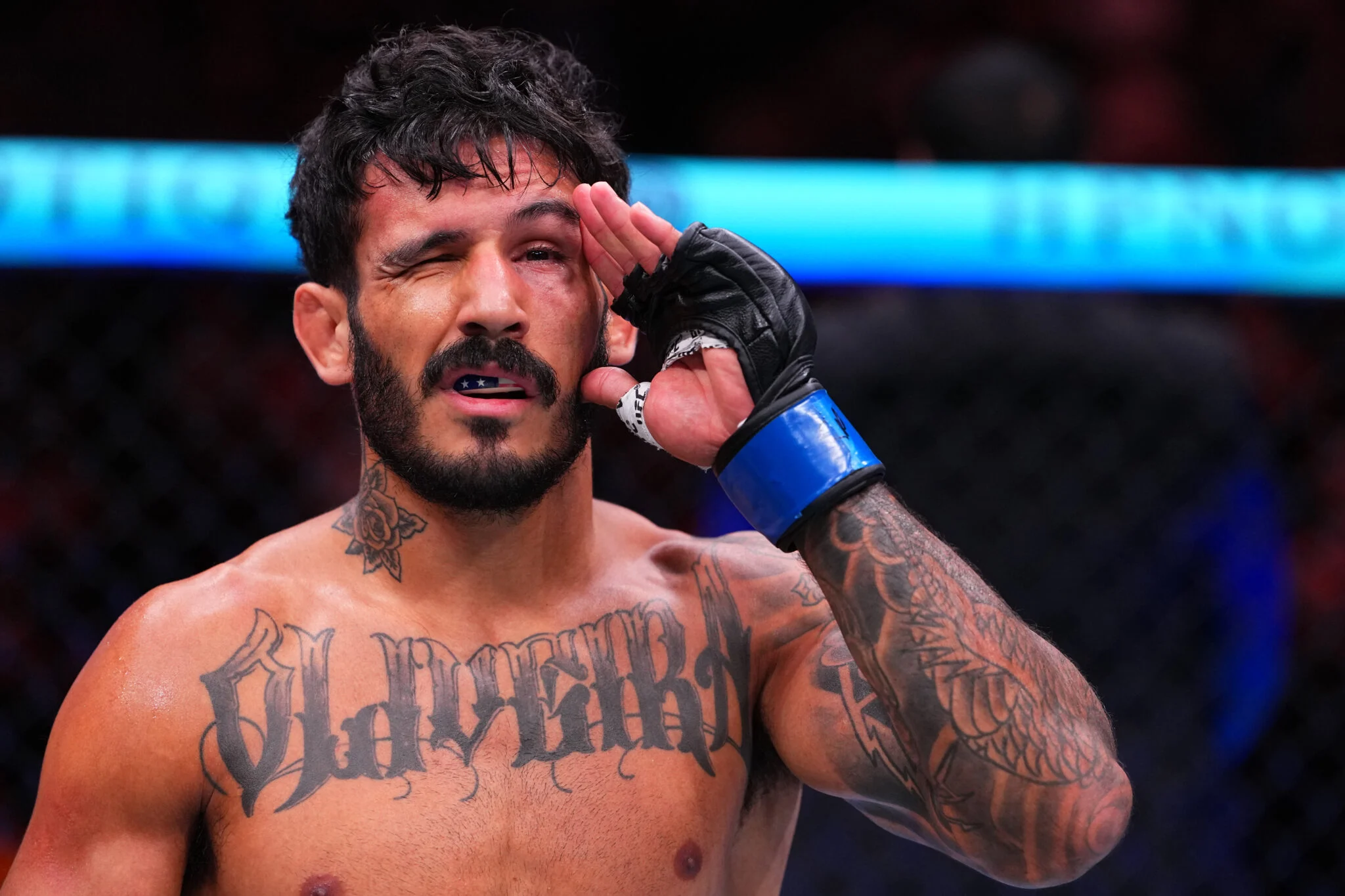 UFC Sacramento: Lerryan Douglas Quebra o Silêncio Após Fratura Orbital e Perda Imediata de Visão em Luta Devastadora