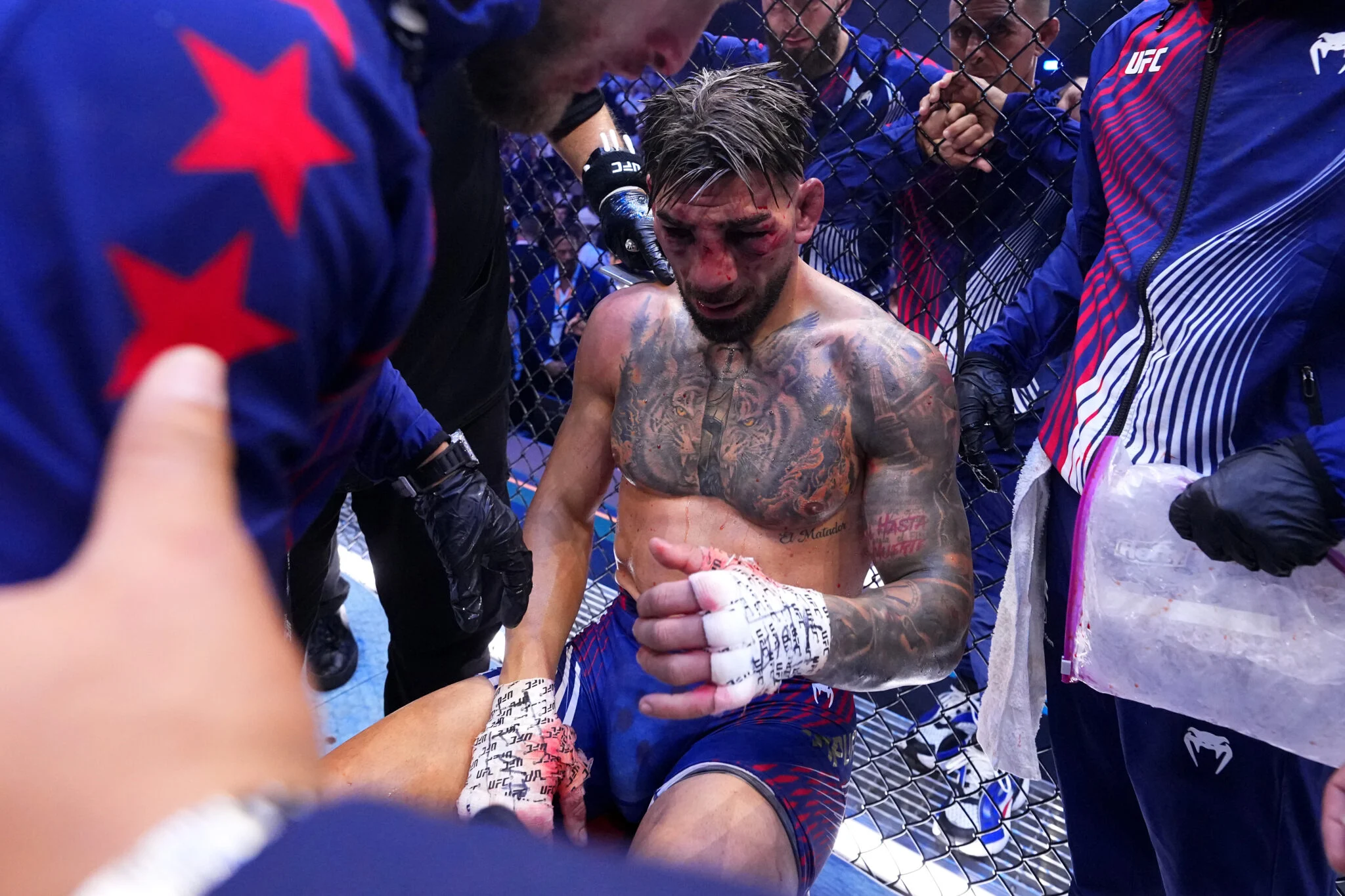 Ilia Topuria Detalha Choque ao Ver o Rosto Quebrado e Não se Reconhecer Após Luta Brutal Contra Justin Gaethje no UFC