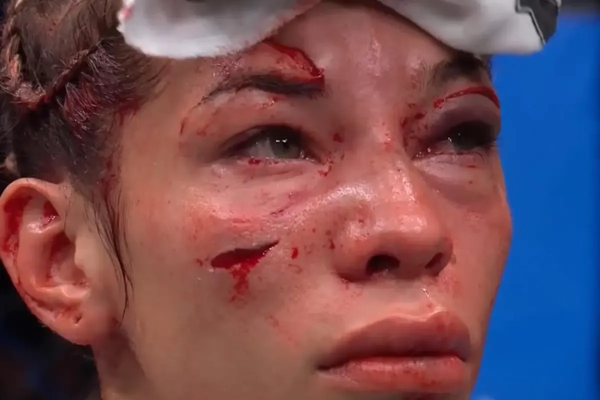 IMAGEM FORTE: Ex-rival de brasileira, Sofia Montenegro é finalizada com brutalidade e tem corte profundo no rosto em estreia no UFC Paris