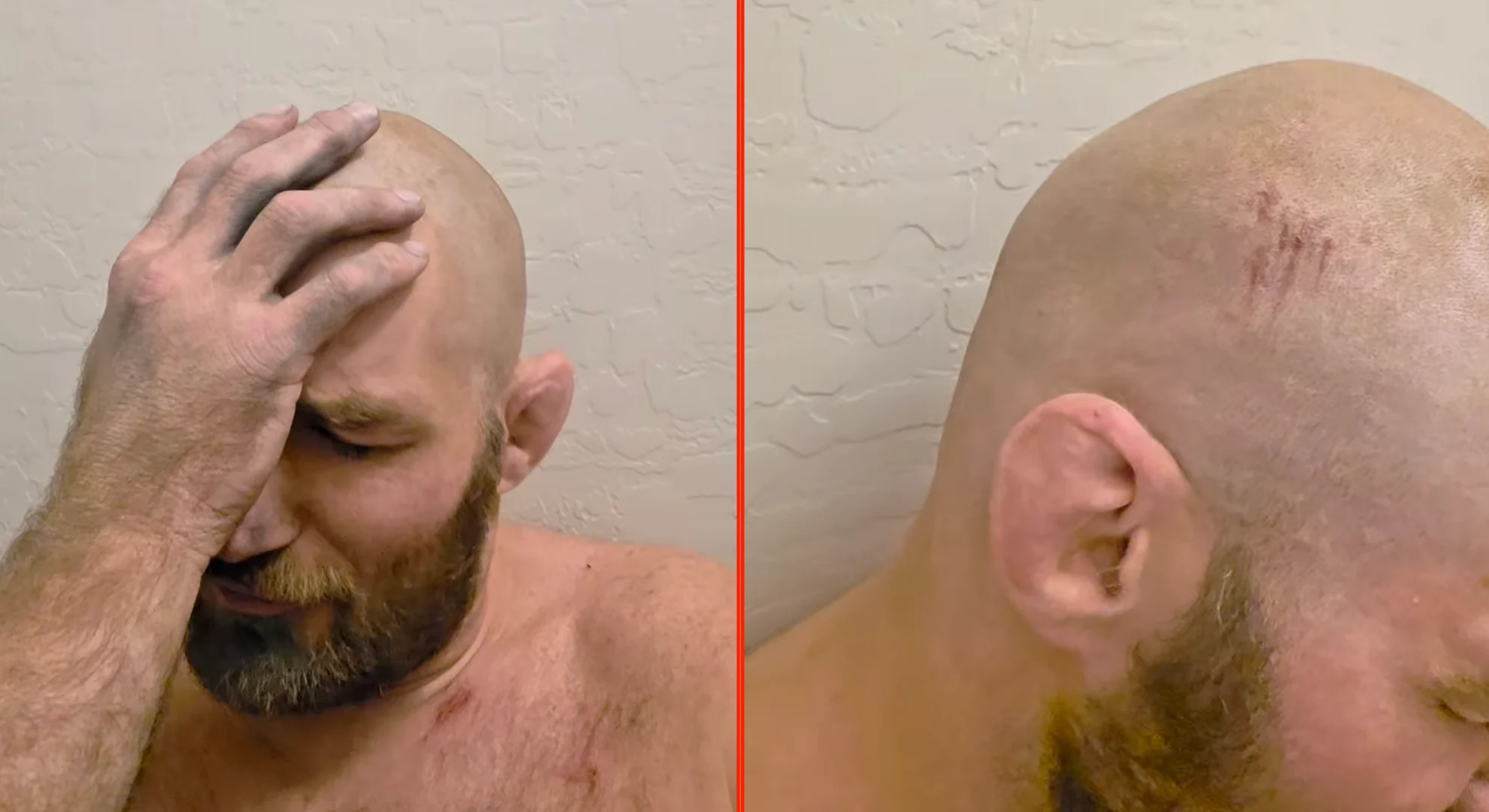 Sean Strickland, Campeão do UFC, Sofre Novo Acidente de Moto Chocante e Revela Detalhes de Capotamento a 96km/h Sem Capacete